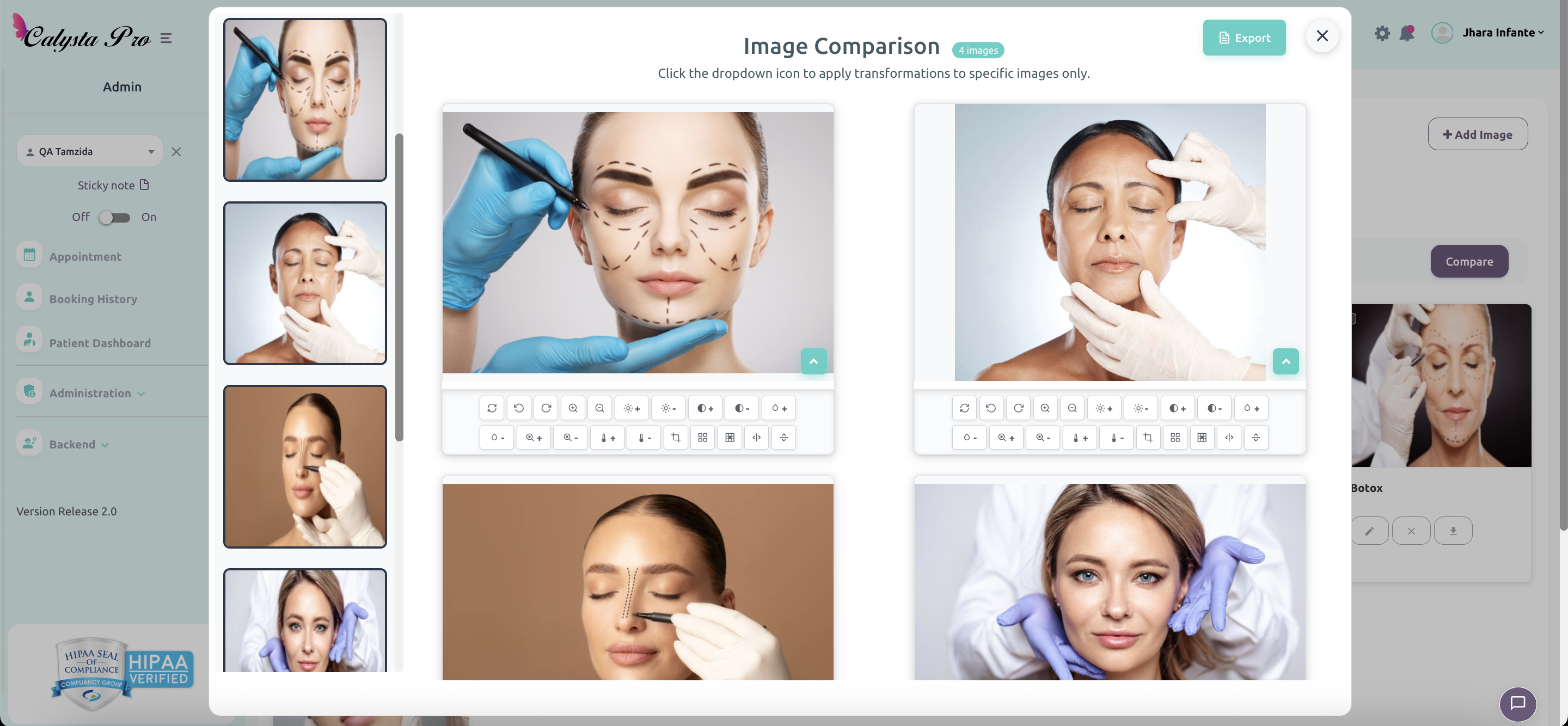 Calysta Pro EMR patient photo storage and comparison